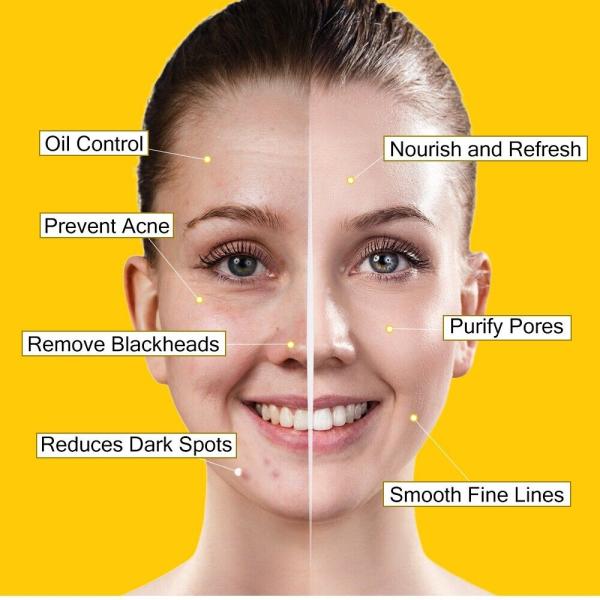 Turmeric Facial Mask Repair Acne Scar Dark Spot Treatment 120g