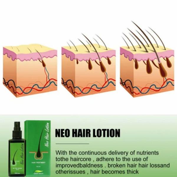Neo Hair Lotion Hair Treatment 120ml Original Thailand