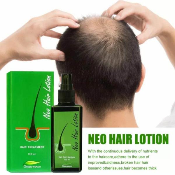 Neo Hair Lotion Hair Treatment 120ml Original Thailand
